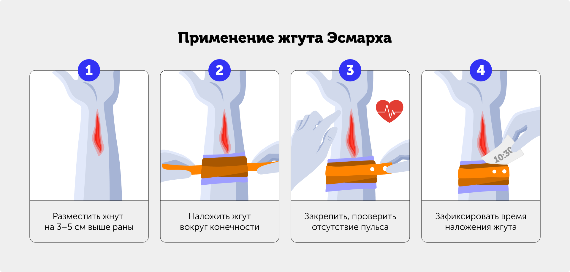 Иллюстрация — применение жгута Эсмарха